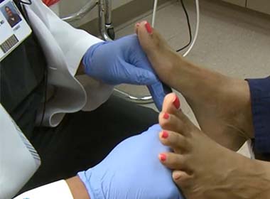 Plantar Fasciitis Surgery Allows Woman to Regain Active Lifestyle